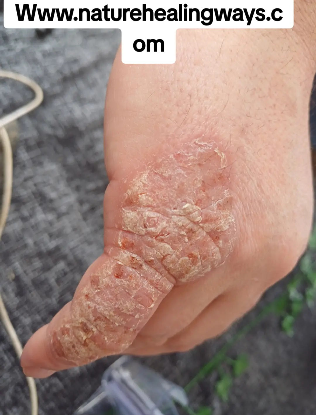 Skin
