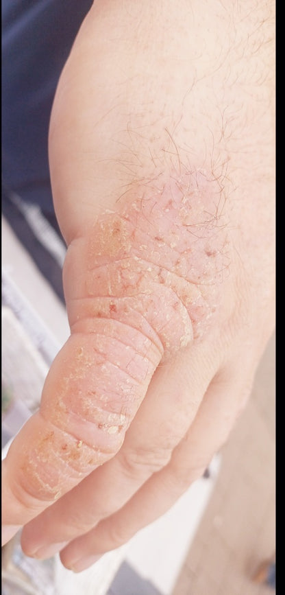 Skin