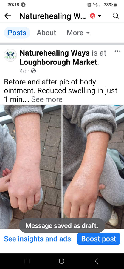 Body